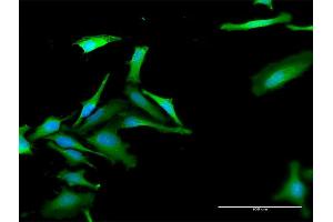 Immunofluorescence of purified MaxPab antibody to FBXO42 on HeLa cell.