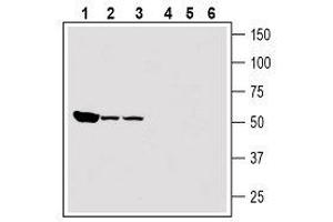 Western blot analysis of rat heart membranes (lanes 1 and 4), mouse kidney membranes (lanes 2 and 5) and rat brain membranes (lanes 3 and 6): - 1-3.