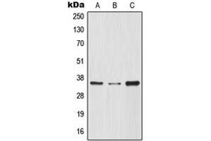 Western blot analysis of IKB alpha expression in THP1 (A), HeLa (B), Raw264. (NFKBIA anticorps  (N-Term))