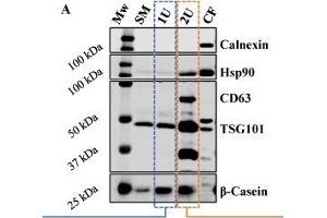 (A) Western Blot analysis of proteins present (Hsp90, CD63 and TSG101) or absent (calnexin) in exosomes and abundant in bovine milk (β-casein). (CD63 anticorps  (AA 101-200))