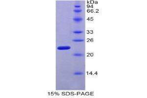 SDS-PAGE (SDS) image for Relaxin 2 (RLN2) (AA 1-185) protein (His tag) (ABIN1878028)