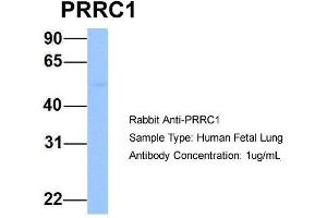 Host: Rabbit  Target Name: PRRC1  Sample Tissue: Human Fetal Lung  Antibody Dilution: 1. (PRRC1 anticorps  (Middle Region))