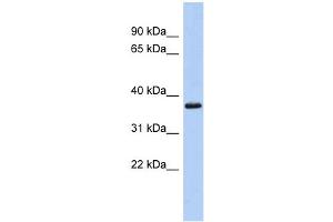 WB Suggested Anti-MBP Antibody Titration: 0.