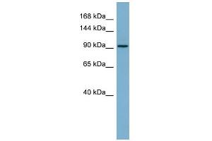 WB Suggested Anti-RAI14 Antibody Titration: 0.