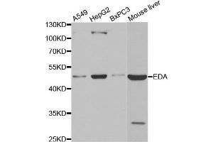 Western blot analysis of extracts of various cell lines, using EDA antibody. (Ectodysplasin A anticorps)