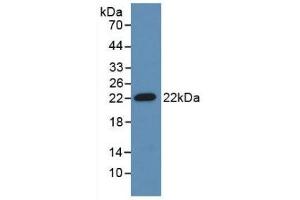 Detection of Recombinant ADM, Mouse using Polyclonal Antibody to Adrenomedullin (ADM)