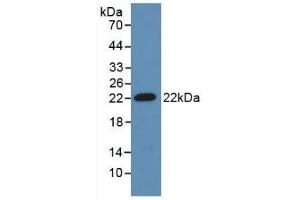 Detection of Recombinant ADM, Mouse using Polyclonal Antibody to Adrenomedullin (ADM) (Adrenomedullin anticorps  (AA 24-171))