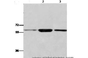 Western Blot analysis of K562,231,Human fetal liver tissue using GPC6 Polyclonal Antibody at dilution of 1:700 (Glypican 6 anticorps)