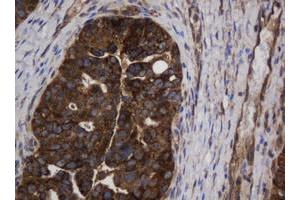 Image no. 4 for anti-Asialoglycoprotein Receptor 2 (ASGR2) antibody (ABIN1496744)