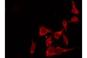 ABIN6276158 staining Hela by IF/ICC.