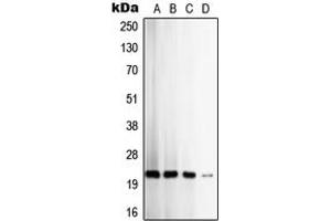 Western blot analysis of TIMP2 expression in HeLa (A), SW480 (B), MCF7 (C), K562 (D) whole cell lysates.
