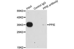 Immunoprecipitation analysis of 200ug extracts of HeLa cells using 1ug PPIE antibody (ABIN2564649).