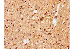 IHC image of ABIN7127752 diluted at 1:100 and staining in paraffin-embedded human brain tissue performed on a Leica BondTM system. (Recombinant SNCA anticorps  (pSer129))