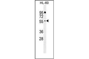 Western blot analysis of FBXW11 Antibody (Center) in HL-60 cell line lysates (35ug/lane). (FBXW11 anticorps  (Middle Region))