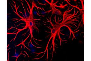 Mixed cultures of neurons and glia stained with chicken anti-GFAP (red), and DNA (blue). (GFAP anticorps)