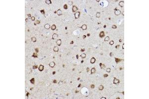 Immunohistochemistry of paraffin-embedded rat brain using CARS Rabbit mAb (ABIN7266624) at dilution of 1:100 (40x lens).