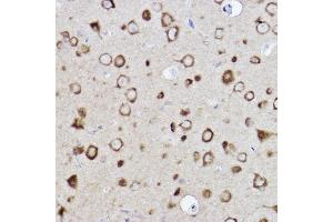 Immunohistochemistry of paraffin-embedded rat brain using CARS Rabbit mAb (ABIN7266624) at dilution of 1:100 (40x lens). (CARS anticorps)