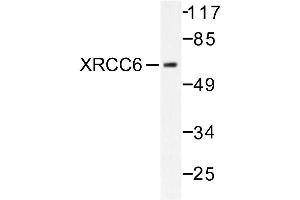 Image no. 1 for anti-X-Ray Repair Complementing Defective Repair in Chinese Hamster Cells 6 (XRCC6) antibody (ABIN271984) (XRCC6 anticorps)