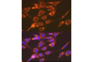 Immunofluorescence analysis of NIH-3T3 cells using Versican Rabbit mAb (ABIN7271309) at dilution of 1:100 (40x lens).