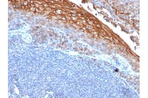 Formalin-fixed, paraffin-embedded human Tonsil stained with MUC18 Mouse Monoclonal Antibody (MUC18/1130). (MCAM anticorps)
