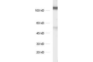 dilution 1 : 1000, sample: synaptic membrane fraction of rat brain (LP1) (DLG3 anticorps)