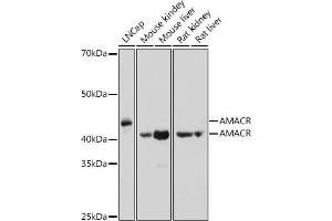 Western blot analysis of extracts of various cell lines, using AMACR antibody (ABIN3021497, ABIN3021498, ABIN3021499 and ABIN6215153) at 1:1000 dilution.