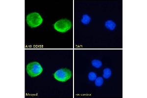 ABIN6391376 Immunofluorescence analysis of paraformaldehyde fixed A431 cells, permeabilized with 0. (DDX58 anticorps  (C-Term))