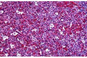 anti-Chemokine (C-X-C Motif) Ligand 5 (CXCL5) (AA 1-115) antibody