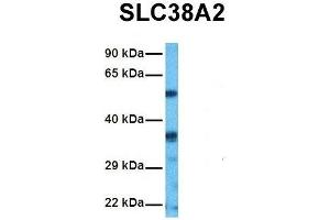 Host:  Rabbit  Target Name:  SLC38A2  Sample Tissue:  Human HepG2  Antibody Dilution:  1. (SLC38A2 anticorps  (N-Term))