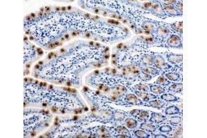 IHC-P: HSP105 antibody testing of rat intestine tissue (HSPH1 anticorps  (AA 713-733))