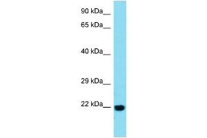 Host:  Rabbit  Target Name:  BTBD2  Sample Type:  Esophagus Tumor lysates  Antibody Dilution:  1. (BTBD2 anticorps  (C-Term))