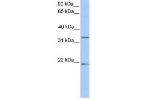WB Suggested Anti-FUT6 Antibody Titration:  0.