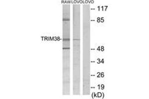 Western blot analysis of extracts from LOVO/RAW264. (TRIM38 anticorps  (AA 161-210))