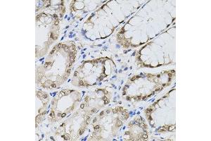 Immunohistochemistry of paraffin-embedded human stomach using MAPK1 antibody.