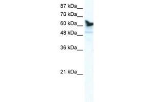 Western Blotting (WB) image for anti-DEAD (Asp-Glu-Ala-Asp) Box Polypeptide 41 (DDX41) antibody (ABIN2461350) (DDX41 anticorps)