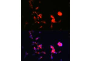 Immunofluorescence analysis of SH-SY5Y cells using DKK3 Rabbit mAb (ABIN1680063, ABIN3018243, ABIN3018244 and ABIN7101586) at dilution of 1:100 (40x lens).