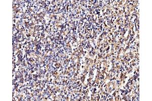 IHC analysis of MPPB/PMPCB using anti-MPPB/PMPCB antibody (ABIN7600758). (PMPCB anticorps  (AA 23-479))