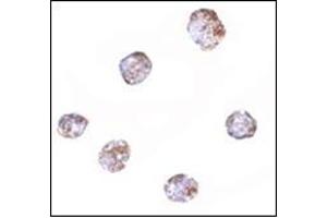 Immunocytochemistry of RGS21 in HepG2 cells with this product at 2. (RGS21 anticorps  (Center))