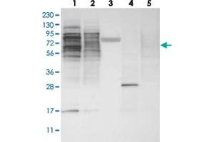 Western blot analysis of Lane 1: RT-4, Lane 2: U-251 MG, Lane 3: Human Plasma, Lane 4: Liver, Lane 5: Tonsil with ZSCAN2 polyclonal antibody . (ZSCAN2 anticorps)