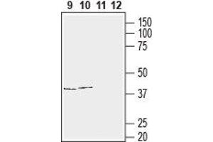 Western blot analysis of human T-cell leukemia (Jurkat) (lanes 9 and 11) and human neuroblastoma (SH-SY5Y) (lanes 10 and 12) cell line lysates:9,10. (Gap Junction Protein, alpha 1, 43kDa (GJA1) Peptide)