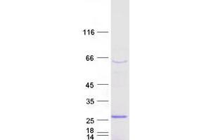 Validation with Western Blot