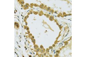Immunohistochemistry of paraffin-embedded human breast using RPS7 antibody.
