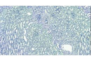 anti-Ewing Sarcoma Breakpoint Region 1 (EWSR1) (Internal Region) antibody