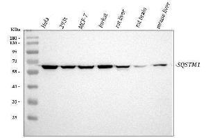Western blot analysis of SQSTM1 using anti-SQSTM1 antibody (ABIN3043937). (SQSTM1 anticorps  (N-Term))