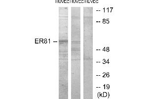 Western blot analysis of extracts from HUVEC cells treated with PMA (125ng/ml, 30mins), and HUVEC cells treated with serum (20%, 30mins), using ER81 antibody.
