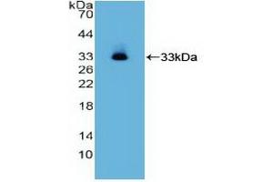 Detection of Recombinant ITGa2, Human using Polyclonal Antibody to Integrin Alpha 2 (ITGa2) (ITGA2 anticorps  (AA 678-894))