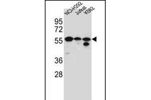 FOXN2 Antibody (N-term) (ABIN656184 and ABIN2845513) western blot analysis in NCI-,Jurkat,K562 cell line lysates (35 μg/lane). (FOXN2 anticorps  (N-Term))