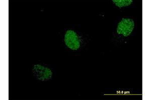 Immunofluorescence of monoclonal antibody to NEUROG1 on HeLa cell.