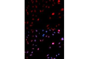 Immunofluorescence analysis of MCF-7 cells using Phospho-CDK1-Y15 antibody (ABIN5969877). (CDK1 anticorps  (pTyr15))