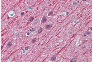 Human Brain, Cortex: Formalin-Fixed, Paraffin-Embedded (FFPE) (TUBB2A anticorps  (AA 1-446))